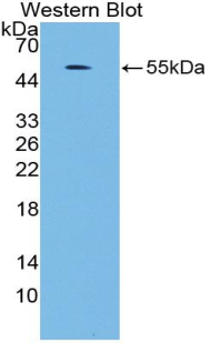 MAPK7 / ERK5 Antibody - Western blot of recombinant MAPK7 / ERK5.