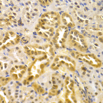 MAPK7 / ERK5 Antibody - Immunohistochemistry of paraffin-embedded rat kidney tissue.