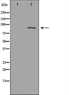 MAPK7 / ERK5 Antibody - Western blot analysis of HeLa whole cells lysates using MAPK7 antibody. The lane on the left is treated with the antigen-specific peptide.