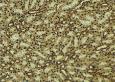 MAPK7 / ERK5 Antibody - 1:100 staining mouse kidney tissue by IHC-P. The sample was formaldehyde fixed and a heat mediated antigen retrieval step in citrate buffer was performed. The sample was then blocked and incubated with the antibody for 1.5 hours at 22°C. An HRP conjugated goat anti-rabbit antibody was used as the secondary.