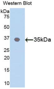 MAPK8 / JNK1 Antibody - Western blot of recombinant MAPK8 / JNK1 / JNK.  This image was taken for the unconjugated form of this product. Other forms have not been tested.
