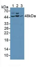 MAPK8 / JNK1 Antibody - Western Blot; Sample: Lane1: Human Hela Cells; Lane2: Human Jurkat Cells; Lane3: Human PC-3 Cells.