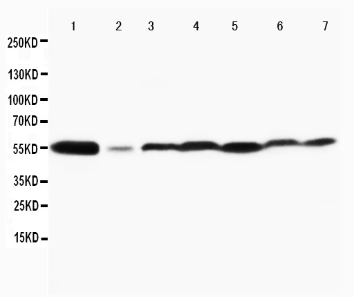 MAPK8 / JNK1 Antibody - WB of MAPK8 / JNK1 / JNK antibody. All lanes: Anti-MAPK8 at 0.5ug/ml. Lane 1: Rat Brain Tissue Lysate at 40ug. Lane 2: Rat Thymus Tissue Lysate at 40ug. Lane 3: MCF-7 Whole Cell Lysate at 40ug. Lane 4: HELA Whole Cell Lysate at 40ug. Lane 5: JURKAT Whole Cell Lysate at 40ug. Lane 6: MM231 Whole Cell Lysate at 40ug. Lane 7: CEM Whole Cell Lysate at 40ug. Predicted bind size: 48KD. Observed bind size: 48KD.