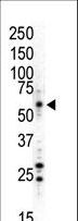 MAPK8 / JNK1 Antibody - Western blot of anti-JNK1 antibody in HL60 (UV-treated) cell lysate. JNK1 (arrow) was detected using purified antibody. Secondary HRP-anti-rabbit was used for signal visualization with chemiluminescence.