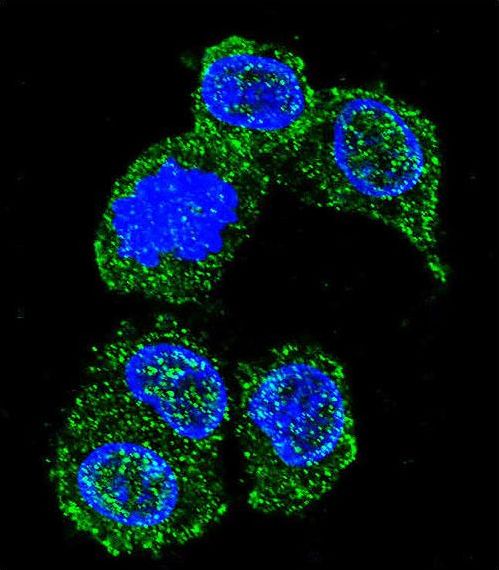 MAPK8 / JNK1 Antibody - Confocal immunofluorescence of MAPK8 Antibody with HepG2 cell followed by Alexa Fluor 488-conjugated goat anti-rabbit lgG (green). DAPI was used to stain the cell nuclear (blue).