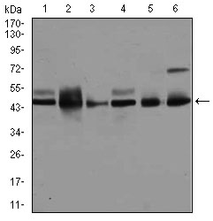 MAPK8 / JNK1 Antibody - Western blot using MAPK8 mouse monoclonal antibody against A431 (1), K562 (2), HeLa (3), NIH3T3 (4), PC-12 (5), and MCF-7 (6) cell lysate.