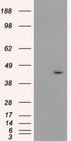 MAPK8 / JNK1 Antibody - Anti-MAPK8 mouse monoclonal antibody  immunofluorescent staining of HeLa cells transiently transfected by pCMV6-ENTRY MAPK8.