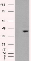 MAPK8 / JNK1 Antibody - HEK293T cells were transfected with the pCMV6-ENTRY control (Left lane) or pCMV6-ENTRY MAPK8 (Right lane) cDNA for 48 hrs and lysed. Equivalent amounts of cell lysates (5 ug per lane) were separated by SDS-PAGE and immunoblotted with anti-MAPK8.