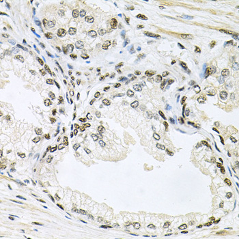 MAPK8 / JNK1 Antibody - Immunohistochemistry of paraffin-embedded human prostate using MAPK8 antibodyat dilution of 1:100 (40x lens).