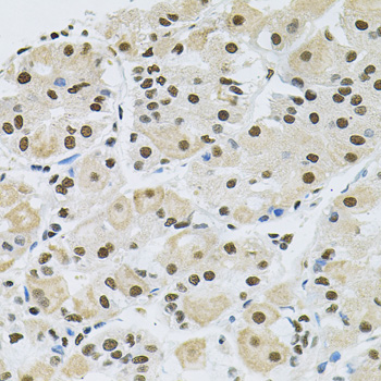 MAPK8 / JNK1 Antibody - Immunohistochemistry of paraffin-embedded human stomach using MAPK8 antibodyat dilution of 1:100 (40x lens).