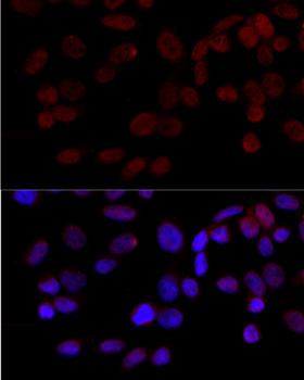 MAPK8 / JNK1 Antibody - Immunofluorescence analysis of HeLa cells using MAPK8 antibodyat dilution of 1:100 (40x lens). Blue: DAPI for nuclear staining.