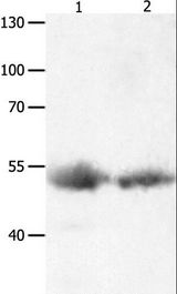 MAPK8 / JNK1 Antibody - Western blot analysis of Human lymphoma and liver cancer tissue, using MAPK8 Polyclonal Antibody at dilution of 1:1000.