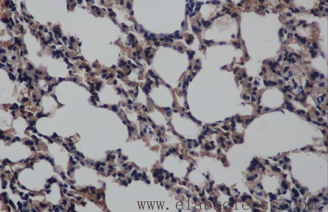 MAPK8 / JNK1 Antibody - Immunohistochemistry of paraffin-embedded mouse lung using MAPK8 Polyclonal Antibody at dilution of 1:50.
