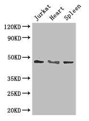 MAPK8 / JNK1 Antibody - Positive WB detected in:Jurkat whole cell lysate,Mouse heart tissue,Mouse spleen tissue;All lanes: MAPK8 antibody at 3ug/ml;Secondary;Goat polyclonal to rabbit IgG at 1/50000 dilution;Predicted band size: 49,45,36 kDa;Observed band size: 49 kDa;