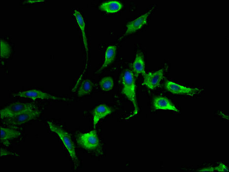 MAPK8 / JNK1 Antibody - Immunofluorescent analysis of Hela cells using MAPK8 Antibody at a dilution of 1:100 and Alexa Fluor 488-congugated AffiniPure Goat Anti-Rabbit IgG(H+L)