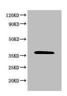 MAPK8 / JNK1 Antibody - Western Blot Positive WB detected in: 293T whole cell lysate All lanes: MAPK8 antibody at 6µg/ml Secondary Goat polyclonal to rabbit IgG at 1/50000 dilution Predicted band size: 49, 45, 36 kDa Observed band size: 36 kDa