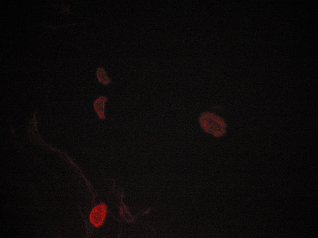 MAPK8 / JNK1 Antibody - Staining LOVO cells by IF/ICC. The samples were fixed with PFA and permeabilized in 0.1% saponin prior to blocking in 10% serum for 45 min at 37°C. The primary antibody was diluted 1/400 and incubated with the sample for 1 hour at 37°C. A Alexa Fluor® 594 conjugated goat polyclonal to rabbit IgG (H+L), diluted 1/600 was used as secondary antibody.