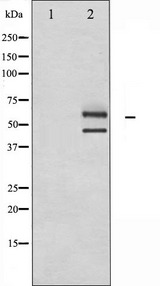 MAPK8 / JNK1 Antibody - Western blot analysis of JNK1/2/3 expression in UV treated 293 whole cells lysates. The lane on the left is treated with the antigen-specific peptide.