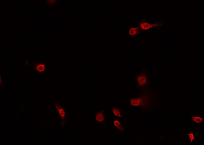 MAPK8 / JNK1 Antibody - Staining 293 cells by IF/ICC. The samples were fixed with PFA and permeabilized in 0.1% Triton X-100, then blocked in 10% serum for 45 min at 25°C. The primary antibody was diluted at 1:200 and incubated with the sample for 1 hour at 37°C. An Alexa Fluor 594 conjugated goat anti-rabbit IgG (H+L) Ab, diluted at 1/600, was used as the secondary antibody.