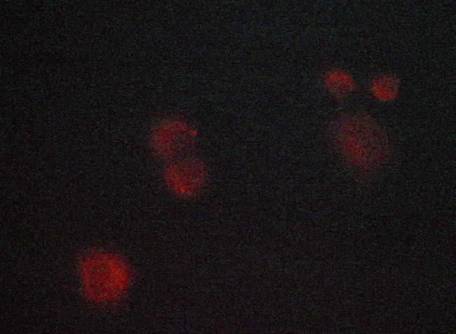 MAPK8 / JNK1 Antibody - Staining MCF-7 cells by IF/ICC. The samples were fixed with PFA and permeabilized in 0.1% saponin prior to blocking in 10% serum for 45 min at 37°C. The primary antibody was diluted 1/400 and incubated with the sample for 1 hour at 37°C. A Alexa Fluor® 594 conjugated goat polyclonal to rabbit IgG (H+L), diluted 1/600 was used as secondary antibody.