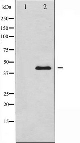 MAPK8 / JNK1 Antibody - Western blot analysis of SAPK/JNK expression in LOVO cells whole cells lysates. The lane on the left is treated with the antigen-specific peptide.