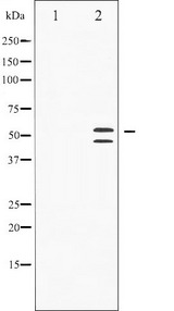 MAPK8 / JNK1 Antibody - Western blot analysis of SAPK/JNK phosphorylation expression in Anisomycin treated HeLa whole cells lysates. The lane on the left is treated with the antigen-specific peptide.