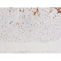 MAPK8 / JNK1 Antibody - 1:200 staining mouse heart tissue by IHC-P. The tissue was formaldehyde fixed and a heat mediated antigen retrieval step in citrate buffer was performed. The tissue was then blocked and incubated with the antibody for 1.5 hours at 22°C. An HRP conjugated goat anti-rabbit antibody was used as the secondary.
