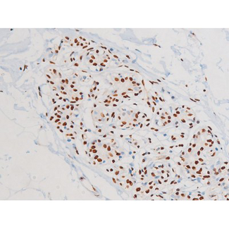MAPK8 / JNK1 Antibody - 1:200 staining human heart tissue by IHC-P. The tissue was formaldehyde fixed and a heat mediated antigen retrieval step in citrate buffer was performed. The tissue was then blocked and incubated with the antibody for 1.5 hours at 22°C. An HRP conjugated goat anti-rabbit antibody was used as the secondary.