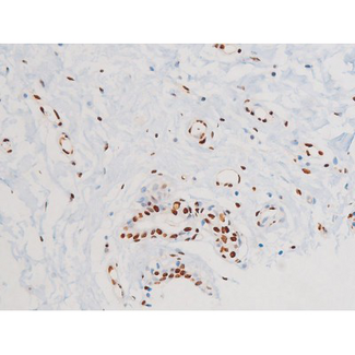 MAPK8 / JNK1 Antibody - 1:200 staining human heart tissue by IHC-P. The tissue was formaldehyde fixed and a heat mediated antigen retrieval step in citrate buffer was performed. The tissue was then blocked and incubated with the antibody for 1.5 hours at 22°C. An HRP conjugated goat anti-rabbit antibody was used as the secondary.