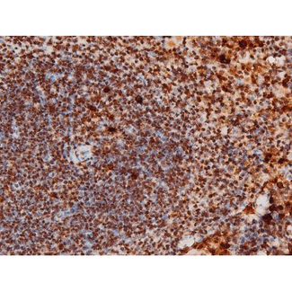 MAPK8 / JNK1 Antibody - 1:200 staining mouse spleen tissue by IHC-P. The tissue was formaldehyde fixed and a heat mediated antigen retrieval step in citrate buffer was performed. The tissue was then blocked and incubated with the antibody for 1.5 hours at 22°C. An HRP conjugated goat anti-rabbit antibody was used as the secondary.