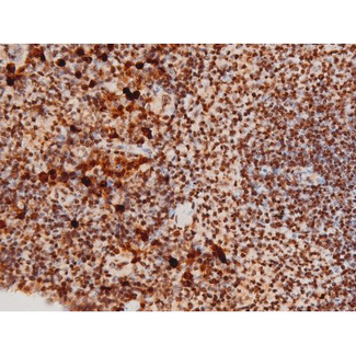 MAPK8 / JNK1 Antibody - 1:200 staining mouse spleen tissue by IHC-P. The tissue was formaldehyde fixed and a heat mediated antigen retrieval step in citrate buffer was performed. The tissue was then blocked and incubated with the antibody for 1.5 hours at 22°C. An HRP conjugated goat anti-rabbit antibody was used as the secondary.