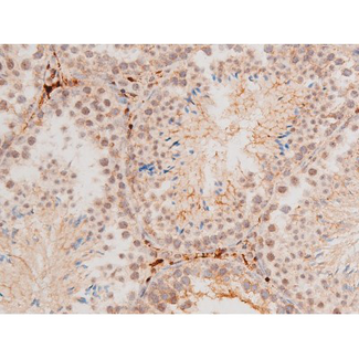 MAPK8 / JNK1 Antibody - 1:200 staining mouse testis tissue by IHC-P. The tissue was formaldehyde fixed and a heat mediated antigen retrieval step in citrate buffer was performed. The tissue was then blocked and incubated with the antibody for 1.5 hours at 22°C. An HRP conjugated goat anti-rabbit antibody was used as the secondary.