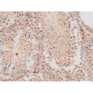 MAPK8 / JNK1 Antibody - 1:200 staining mouse testis tissue by IHC-P. The tissue was formaldehyde fixed and a heat mediated antigen retrieval step in citrate buffer was performed. The tissue was then blocked and incubated with the antibody for 1.5 hours at 22°C. An HRP conjugated goat anti-rabbit antibody was used as the secondary.