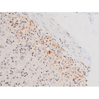 MAPK8 / JNK1 Antibody - 1:200 staining rat ganstric tissue by IHC-P. The tissue was formaldehyde fixed and a heat mediated antigen retrieval step in citrate buffer was performed. The tissue was then blocked and incubated with the antibody for 1.5 hours at 22°C. An HRP conjugated goat anti-rabbit antibody was used as the secondary.