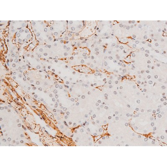MAPK8 / JNK1 Antibody - 1:200 staining rat kidney tissue by IHC-P. The tissue was formaldehyde fixed and a heat mediated antigen retrieval step in citrate buffer was performed. The tissue was then blocked and incubated with the antibody for 1.5 hours at 22°C. An HRP conjugated goat anti-rabbit antibody was used as the secondary.