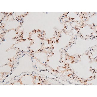 MAPK8 / JNK1 Antibody - 1:200 staining rat lung tissue by IHC-P. The tissue was formaldehyde fixed and a heat mediated antigen retrieval step in citrate buffer was performed. The tissue was then blocked and incubated with the antibody for 1.5 hours at 22°C. An HRP conjugated goat anti-rabbit antibody was used as the secondary.