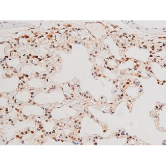 MAPK8 / JNK1 Antibody - 1:200 staining rat lung tissue by IHC-P. The tissue was formaldehyde fixed and a heat mediated antigen retrieval step in citrate buffer was performed. The tissue was then blocked and incubated with the antibody for 1.5 hours at 22°C. An HRP conjugated goat anti-rabbit antibody was used as the secondary.