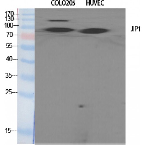 MAPK8IP1 / JIP1 Antibody - Western blot of JIP-1 antibody