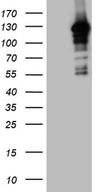 MAPK8IP1 / JIP1 Antibody - HEK293T cells were transfected with the pCMV6-ENTRY control. (Left lane) or pCMV6-ENTRY MAPK8IP1. (Right lane) cDNA for 48 hrs and lysed