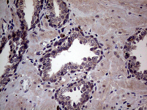 MAPK8IP1 / JIP1 Antibody - Immunohistochemical staining of paraffin-embedded Human prostate tissue within the normal limits using anti-MAPK8IP1 mouse monoclonal antibody. (Heat-induced epitope retrieval by 1mM EDTA in 10mM Tris buffer. (pH8.5) at 120°C for 3 min. (1:150)