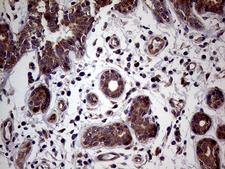 MAPK8IP1 / JIP1 Antibody - Immunohistochemical staining of paraffin-embedded Human breast tissue within the normal limits using anti-MAPK8IP1 mouse monoclonal antibody. (Heat-induced epitope retrieval by 1mM EDTA in 10mM Tris buffer. (pH8.5) at 120°C for 3 min. (1:150)