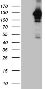 MAPK8IP1 / JIP1 Antibody - HEK293T cells were transfected with the pCMV6-ENTRY control. (Left lane) or pCMV6-ENTRY MAPK8IP1. (Right lane) cDNA for 48 hrs and lysed