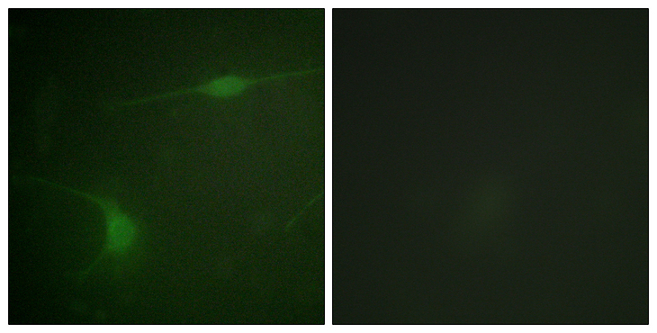 MAPK8IP1 / JIP1 Antibody - Immunofluorescence analysis of NIH/3T3 cells, using JIP1 (Phospho-Thr103) Antibody. The picture on the right is blocked with the phospho peptide.