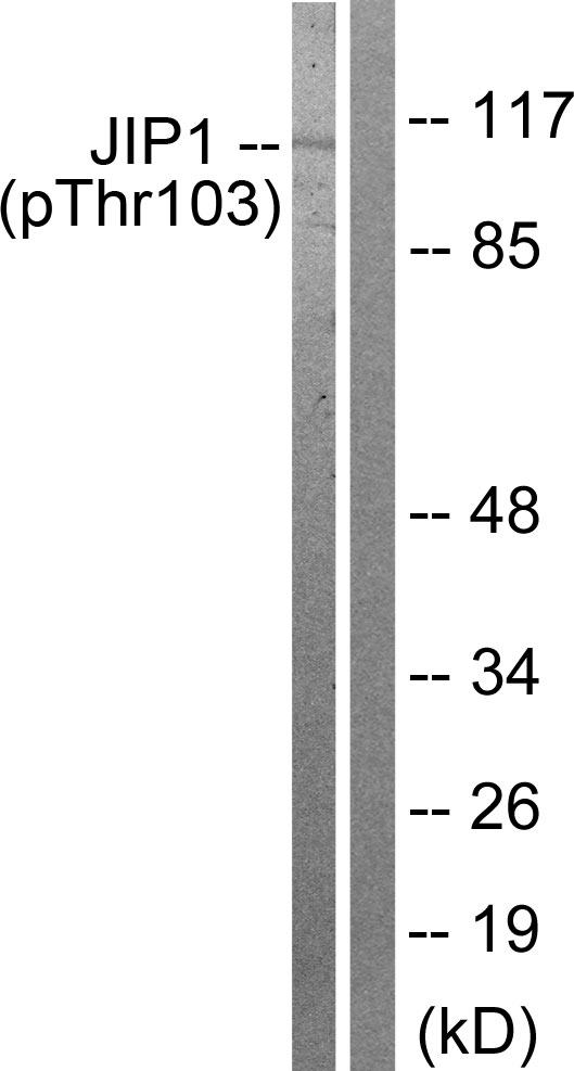 MAPK8IP1 / JIP1 Antibody - Western blot analysis of lysates from COLO205 cells treated with Serum 20% 15', using JIP1 (Phospho-Thr103) Antibody. The lane on the right is blocked with the phospho peptide.