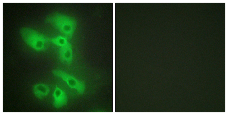 MAPK8IP2 / JIP2 Antibody - Immunofluorescence analysis of HeLa cells, using JIP2 Antibody. The picture on the right is blocked with the synthesized peptide.