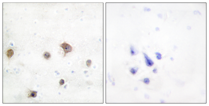 MAPK8IP2 / JIP2 Antibody - Immunohistochemistry analysis of paraffin-embedded human brain tissue, using JIP2 Antibody. The picture on the right is blocked with the synthesized peptide.