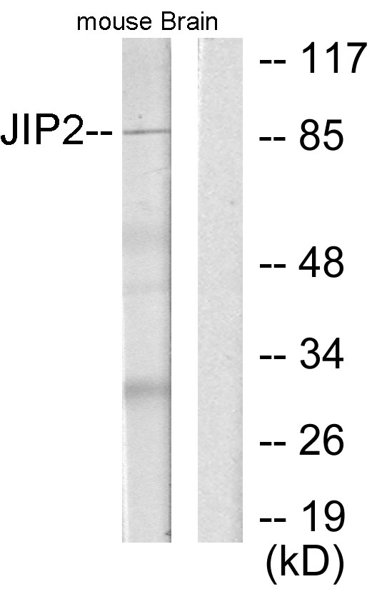 MAPK8IP2 / JIP2 Antibody - Western blot analysis of lysates from mouse brain, using JIP2 Antibody. The lane on the right is blocked with the synthesized peptide.