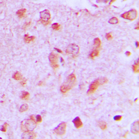 MAPK8IP2 / JIP2 Antibody - Immunohistochemical analysis of JIP2 staining in human brain formalin fixed paraffin embedded tissue section. The section was pre-treated using heat mediated antigen retrieval with sodium citrate buffer (pH 6.0). The section was then incubated with the antibody at room temperature and detected using an HRP conjugated compact polymer system. DAB was used as the chromogen. The section was then counterstained with hematoxylin and mounted with DPX.