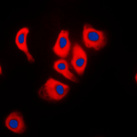 MAPK8IP2 / JIP2 Antibody - Immunofluorescent analysis of JIP2 staining in Raw264.7 cells. Formalin-fixed cells were permeabilized with 0.1% Triton X-100 in TBS for 5-10 minutes and blocked with 3% BSA-PBS for 30 minutes at room temperature. Cells were probed with the primary antibody in 3% BSA-PBS and incubated overnight at 4 C in a humidified chamber. Cells were washed with PBST and incubated with a DyLight 594-conjugated secondary antibody (red) in PBS at room temperature in the dark. DAPI was used to stain the cell nuclei (blue).