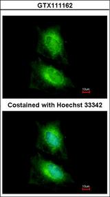 MAPK8IP2 / JIP2 Antibody - Immunofluorescence of methanol-fixed HeLa, using JIP2 antibody at 1:200 dilution.